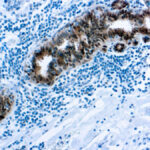 Immunohistochemical staining of Heat Shock Protein 70  of human FFPE tissue followed by incubation with HRP labeled secondary and development with DAB substrate.