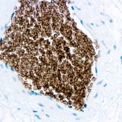 Immunohistochemical staining of Glycophorin C  of human FFPE tissue followed by incubation with HRP labeled secondary and development with DAB substrate.