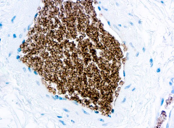 Immunohistochemical staining of Glycophorin C  of human FFPE tissue followed by incubation with HRP labeled secondary and development with DAB substrate.