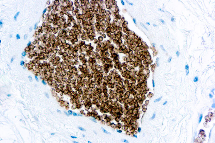 Immunohistochemical staining of Glycophorin C  of human FFPE tissue followed by incubation with HRP labeled secondary and development with DAB substrate.