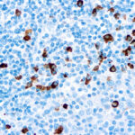 Immunohistochemical staining of IgA  of human FFPE tissue followed by incubation with HRP labeled secondary and development with DAB substrate.