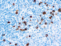 Immunohistochemical staining of IgA  of human FFPE tissue followed by incubation with HRP labeled secondary and development with DAB substrate.