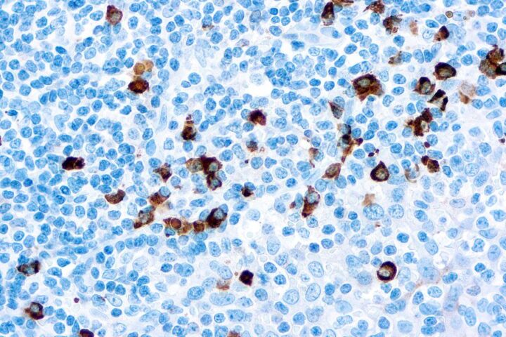 Immunohistochemical staining of IgA  of human FFPE tissue followed by incubation with HRP labeled secondary and development with DAB substrate.