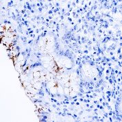 Immunohistochemical staining of Helicobacter Pylori  of human FFPE tissue followed by incubation with HRP labeled secondary and development with DAB substrate.