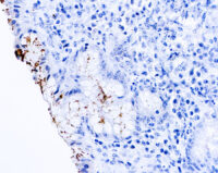 Immunohistochemical staining of Helicobacter Pylori  of human FFPE tissue followed by incubation with HRP labeled secondary and development with DAB substrate.