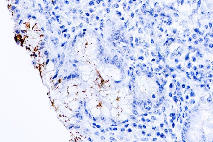 Immunohistochemical staining of Helicobacter Pylori  of human FFPE tissue followed by incubation with HRP labeled secondary and development with DAB substrate.