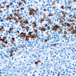 Immunohistochemical staining of IgG  of human FFPE tissue followed by incubation with HRP labeled secondary and development with DAB substrate.