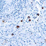 Immunohistochemical staining of IgM  of human FFPE tissue followed by incubation with HRP labeled secondary and development with DAB substrate.
