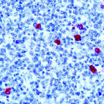 Immunohistochemical staining of IgM  of human FFPE tissue followed by incubation with HRP labeled secondary and development with DAB substrate.