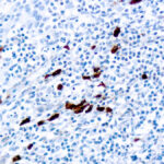 Immunohistochemical staining of IgD  of human FFPE tissue followed by incubation with HRP labeled secondary and development with DAB substrate.