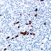 Immunohistochemical staining of IgD  of human FFPE tissue followed by incubation with HRP labeled secondary and development with DAB substrate.