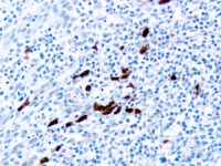 Immunohistochemical staining of IgD  of human FFPE tissue followed by incubation with HRP labeled secondary and development with DAB substrate.