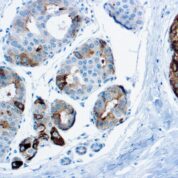 Immunohistochemical staining of GCDFP-15  of human FFPE tissue followed by incubation with HRP labeled secondary and development with DAB substrate.