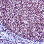 Immunohistochemical staining of Ku  of human FFPE tissue followed by incubation with HRP labeled secondary and development with DAB substrate.