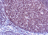 Immunohistochemical staining of Ku  of human FFPE tissue followed by incubation with HRP labeled secondary and development with DAB substrate.