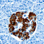 Immunohistochemical staining of Insulin  of human FFPE tissue followed by incubation with HRP labeled secondary and development with DAB substrate.