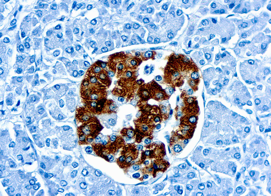 Immunohistochemical staining of Insulin  of human FFPE tissue followed by incubation with HRP labeled secondary and development with DAB substrate.