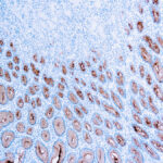 Immunohistochemical staining of Mucin 5AC/Gastric Mucin  of human FFPE tissue followed by incubation with HRP labeled secondary and development with DAB substrate.