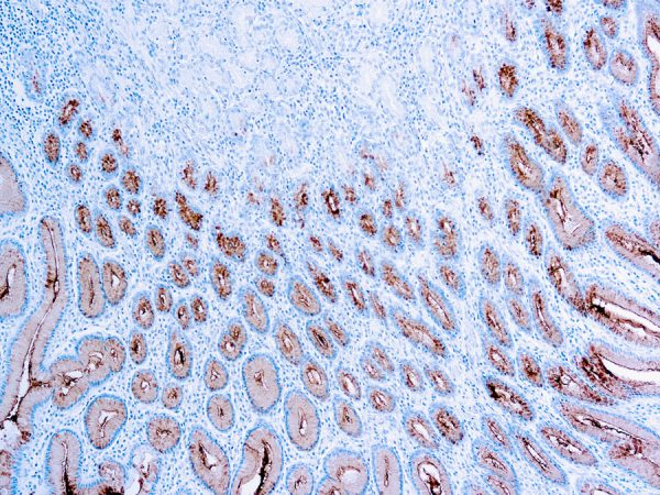 Immunohistochemical staining of Mucin 5AC/Gastric Mucin  of human FFPE tissue followed by incubation with HRP labeled secondary and development with DAB substrate.