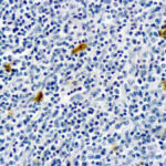 Immunohistochemical staining of IgE  of human FFPE tissue followed by incubation with HRP labeled secondary and development with DAB substrate.