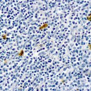 Immunohistochemical staining of IgE  of human FFPE tissue followed by incubation with HRP labeled secondary and development with DAB substrate.
