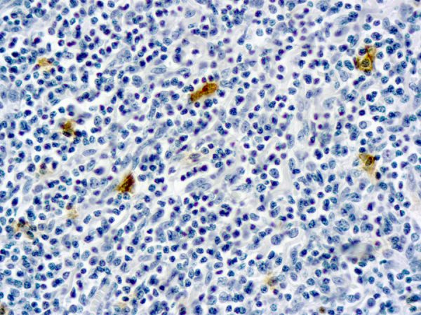 Immunohistochemical staining of IgE  of human FFPE tissue followed by incubation with HRP labeled secondary and development with DAB substrate.