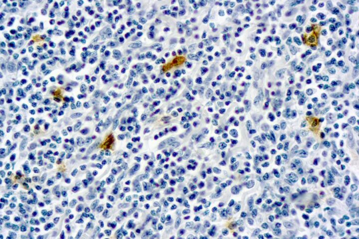 Immunohistochemical staining of IgE  of human FFPE tissue followed by incubation with HRP labeled secondary and development with DAB substrate.