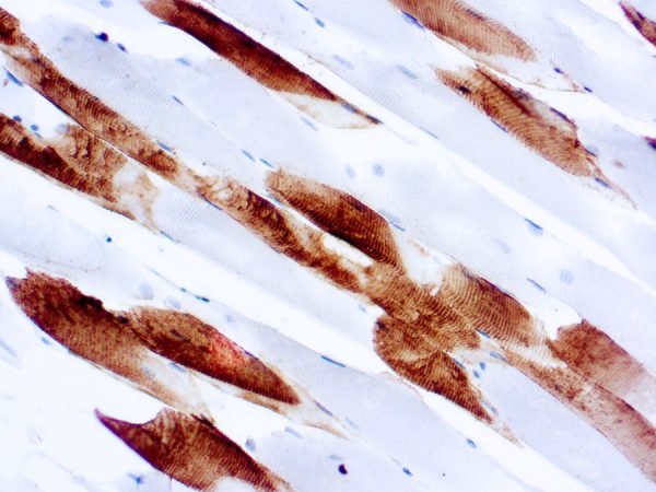 Immunohistochemical staining of Myosin, Skeletal  of human FFPE tissue followed by incubation with HRP labeled secondary and development with DAB substrate.
