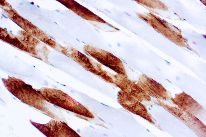 Immunohistochemical staining of Myosin, Skeletal  of human FFPE tissue followed by incubation with HRP labeled secondary and development with DAB substrate.