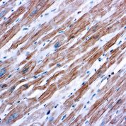 Immunohistochemical staining of alpha-Actinin, Sarcomeric  of human FFPE tissue followed by incubation with HRP labeled secondary and development with DAB substrate.