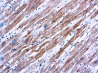 Immunohistochemical staining of alpha-Actinin, Sarcomeric  of human FFPE tissue followed by incubation with HRP labeled secondary and development with DAB substrate.