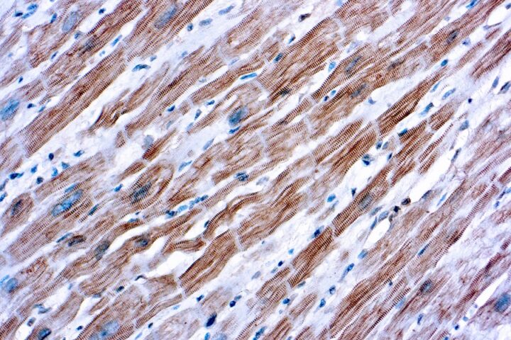 Immunohistochemical staining of alpha-Actinin, Sarcomeric  of human FFPE tissue followed by incubation with HRP labeled secondary and development with DAB substrate.