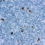 Immunohistochemical staining of CD15/Granulocyte Associated  of human FFPE tissue followed by incubation with HRP labeled secondary and development with DAB substrate.