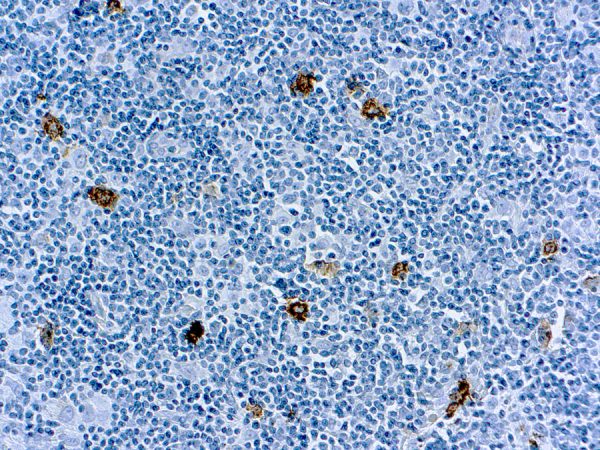 Immunohistochemical staining of CD15/Granulocyte Associated  of human FFPE tissue followed by incubation with HRP labeled secondary and development with DAB substrate.