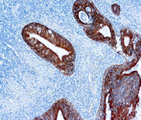 Immunohistochemical staining of pan-Cytokeratins  of human FFPE tissue followed by incubation with HRP labeled secondary and development with DAB substrate.