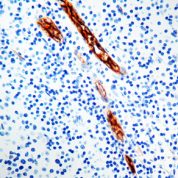 Immunohistochemical staining of Factor VIII Related /Von Willebrand Factor  of human FFPE tissue followed by incubation with HRP labeled secondary and development with DAB substrate.