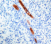 Immunohistochemical staining of Factor VIII Related /Von Willebrand Factor  of human FFPE tissue followed by incubation with HRP labeled secondary and development with DAB substrate.