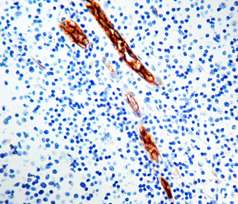 Immunohistochemical staining of Factor VIII Related /Von Willebrand Factor  of human FFPE tissue followed by incubation with HRP labeled secondary and development with DAB substrate.