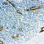 Immunohistochemical staining of Factor VIII Related /Von Willebrand Factor  of human FFPE tissue followed by incubation with HRP labeled secondary and development with DAB substrate.