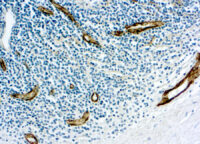 Immunohistochemical staining of Factor VIII Related /Von Willebrand Factor  of human FFPE tissue followed by incubation with HRP labeled secondary and development with DAB substrate.