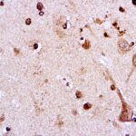 Immunohistochemical staining of Amyloid Precursor Protein  of human FFPE tissue followed by incubation with HRP labeled secondary and development with DAB substrate.