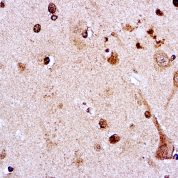 Immunohistochemical staining of Amyloid Precursor Protein  of human FFPE tissue followed by incubation with HRP labeled secondary and development with DAB substrate.