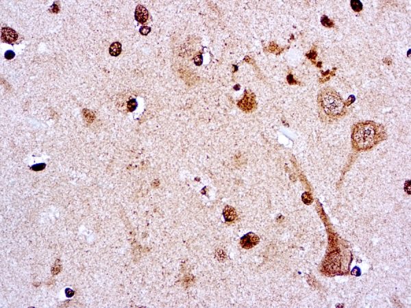 Immunohistochemical staining of Amyloid Precursor Protein  of human FFPE tissue followed by incubation with HRP labeled secondary and development with DAB substrate.