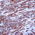 Immunohistochemical staining of Actin, Muscle  of human FFPE tissue followed by incubation with HRP labeled secondary and development with DAB substrate.