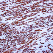 Immunohistochemical staining of Actin, Muscle  of human FFPE tissue followed by incubation with HRP labeled secondary and development with DAB substrate.