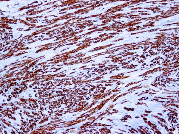 Immunohistochemical staining of Actin, Muscle  of human FFPE tissue followed by incubation with HRP labeled secondary and development with DAB substrate.
