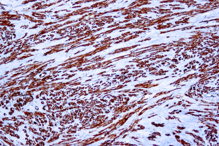 Immunohistochemical staining of Actin, Muscle  of human FFPE tissue followed by incubation with HRP labeled secondary and development with DAB substrate.