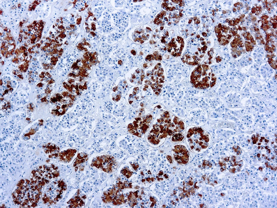 Immunohistochemical staining of ACTH  of human FFPE tissue followed by incubation with HRP labeled secondary and development with DAB substrate.