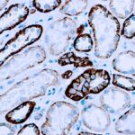 Immunohistochemical staining of Cadherin, Pan  of human FFPE tissue followed by incubation with HRP labeled secondary and development with DAB substrate.