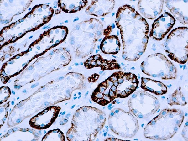Immunohistochemical staining of Cadherin, Pan  of human FFPE tissue followed by incubation with HRP labeled secondary and development with DAB substrate.